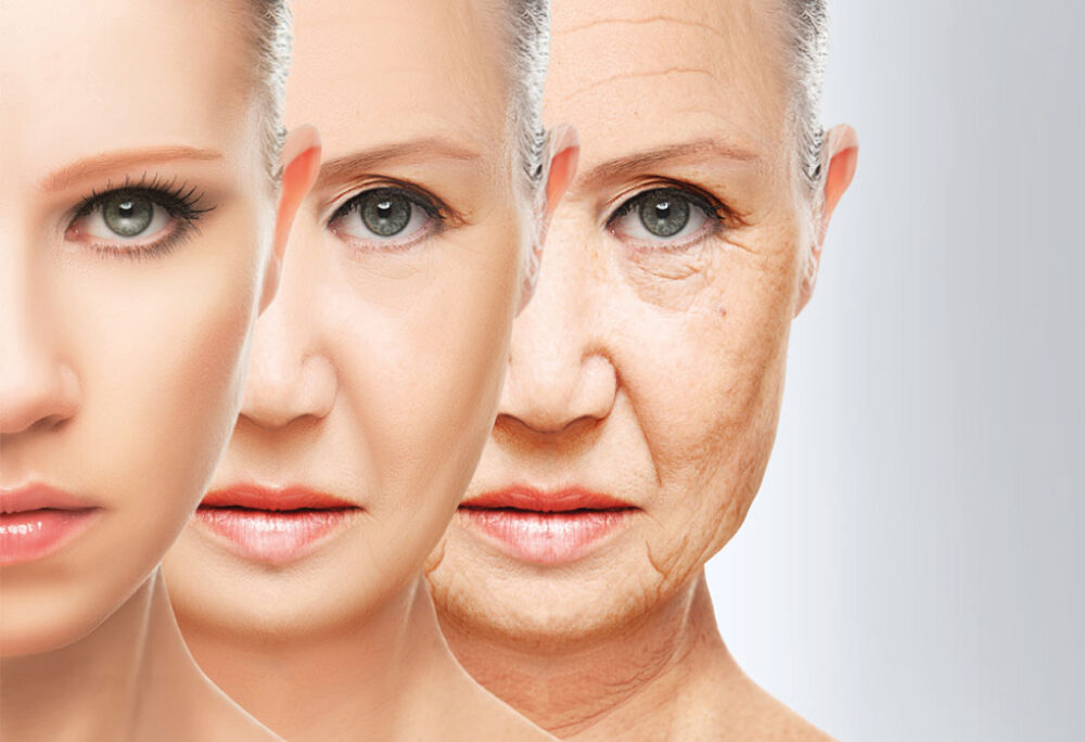 Rejuvenecimiento de la parte superior de la cara